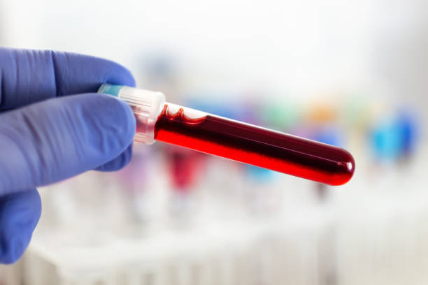 Blood Test Analysis