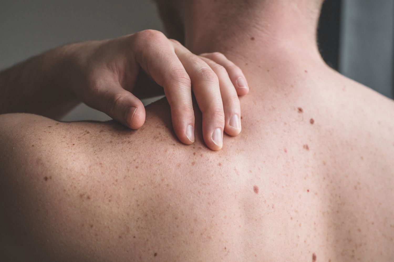 Skin Lesion Classification