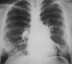 Medical Image Classification